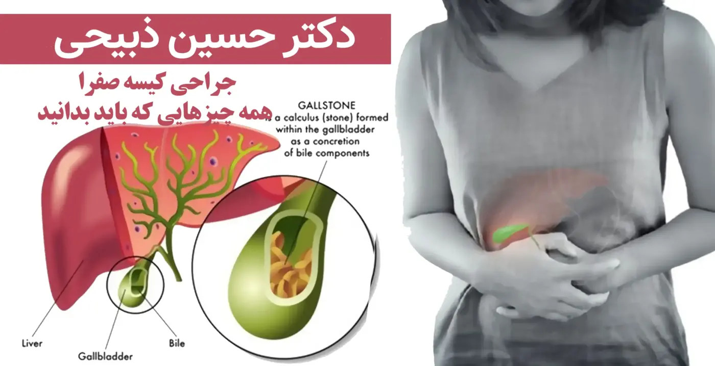 جراحی کیسه صفرا: همه چیزهایی که باید بدانید